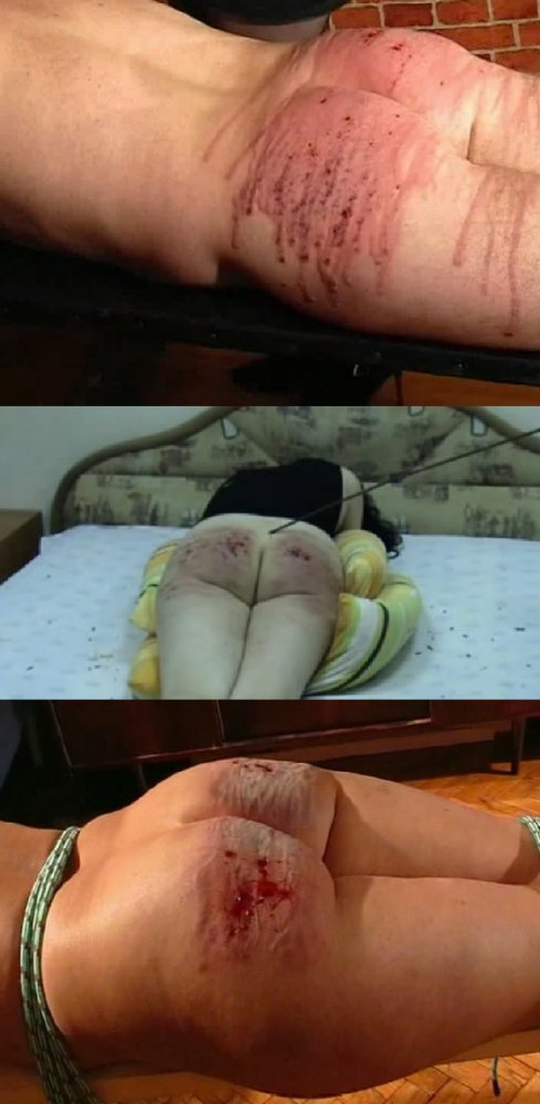 489px x 1000px - Bloody Spanking | Most extremely adult pornblog